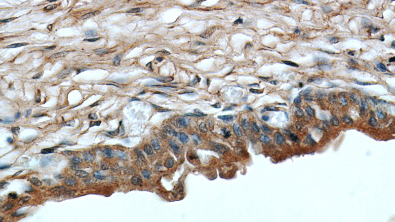 Immunohistochemical of paraffin-embedded human bladder using Catalog No:113019(NALP3 antibody) at dilution of 1:200 (under 40x lens)