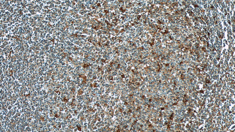 Immunohistochemistry of paraffin-embedded human tonsillitis tissue slide using Catalog No:109183(CEP63 Antibody) at dilution of 1:50 (under 10x lens)