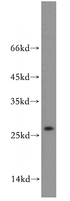 K-562 cells were subjected to SDS PAGE followed by western blot with Catalog No:110173(EIF1AD antibody) at dilution of 1:500