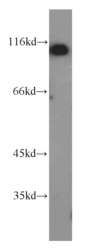 HeLa cells were subjected to SDS PAGE followed by western blot with Catalog No:116586(USP10 antibody) at dilution of 1:500