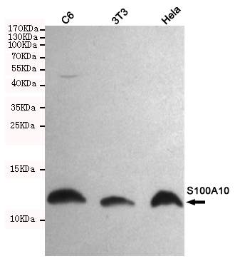 Western blot detection of S100A10 in C6,3T3 and Hela cell lysates using S100A10 mouse mAb (1:1000 diluted).Predicted band size:11KDa.Observed band size:11KDa.