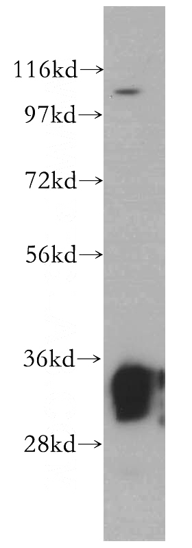 mouse brain tissue were subjected to SDS PAGE followed by western blot with Catalog No:112184(LDHB antibody) at dilution of 1:2000