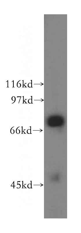 human testis tissue were subjected to SDS PAGE followed by western blot with Catalog No:116659(UBQLN3 antibody) at dilution of 1:800