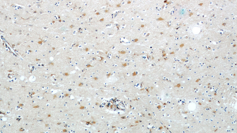 Immunohistochemical of paraffin-embedded human brain using Catalog No:113333(OGFOD2 antibody) at dilution of 1:50 (under 10x lens)