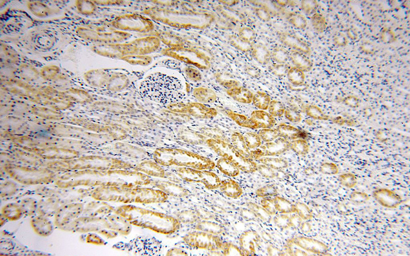 Immunohistochemical of paraffin-embedded human kidney using Catalog No:115320(SLC25A1 antibody) at dilution of 1:100 (under 10x lens)