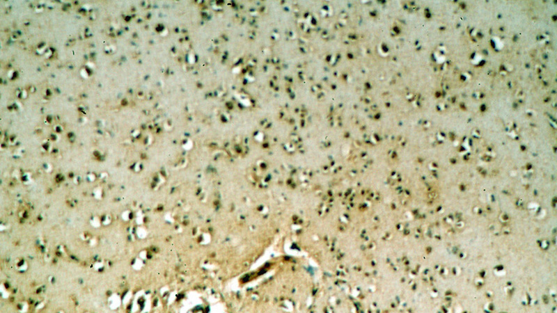 Immunohistochemical of paraffin-embedded human brain using Catalog No:114071(POU3F3-Specific antibody) at dilution of 1:100 (under 10x lens)