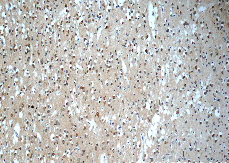 Immunohistochemistry of paraffin-embedded human brain slide using Catalog No:115455(SNRNP48 Antibody) at dilution of 1:50