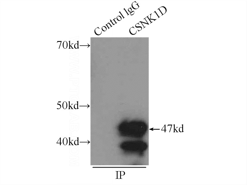 IP Result of anti-CSNK1D (IP:Catalog No:108865, 3ug; Detection:Catalog No:108865 1:1000) with HeLa cells lysate 2000ug.