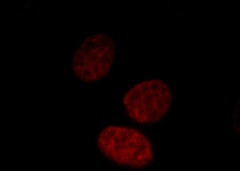 Immunofluorescent analysis of HepG2 cells, using MATR3 antibody Catalog No: at 1:25 dilution and Rhodamine-labeled goat anti-rabbit IgG (red).