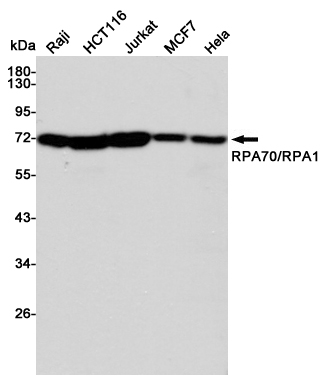 Western blot detection of RPA70/RPA1 in Raji,HCT116,Jurkat,MCF7 and Hela cell lysates using RPA70/RPA1 mouse mAb(dilution 1:1000).Predicted band size:68kDa.Observed band size:70kDa.