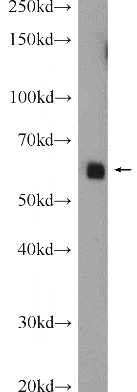 mouse testis tissue were subjected to SDS PAGE followed by western blot with Catalog No:115271(SHE Antibody) at dilution of 1:300