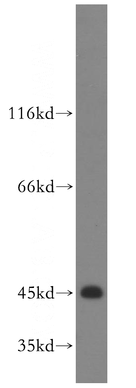 K-562 cells were subjected to SDS PAGE followed by western blot with Catalog No:114925(RRM2 antibody) at dilution of 1:200