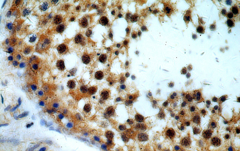 Immunohistochemical of paraffin-embedded human testis using Catalog No:112792(MTOR antibody) at dilution of 1:50 (under 40x lens)