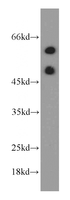 HeLa cells were subjected to SDS PAGE followed by western blot with Catalog No:111047(GORAB antibody) at dilution of 1:500