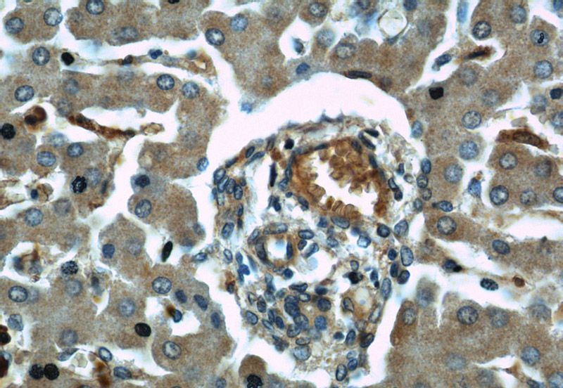 Immunohistochemical of paraffin-embedded human liver using Catalog No:113077(NDUFB8 antibody) at dilution of 1:50 (under 40x lens)