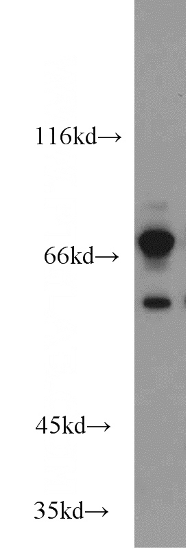 mouse skeletal muscle tissue were subjected to SDS PAGE followed by western blot with Catalog No:111241(GTPBP1 antibody) at dilution of 1:600