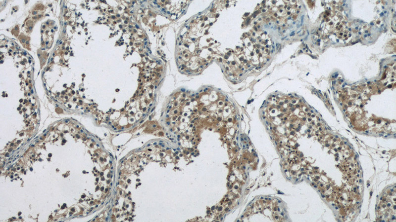 Immunohistochemistry of paraffin-embedded human testis tissue slide using Catalog No:111170(GSK3B Antibody) at dilution of 1:50 (under 10x lens)