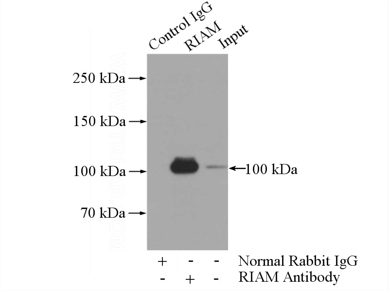 IP Result of anti-RIAM,APBB1IP (IP:Catalog No:114694, 5ug; Detection:Catalog No:114694 1:500) with Jurkat cells lysate 2400ug.