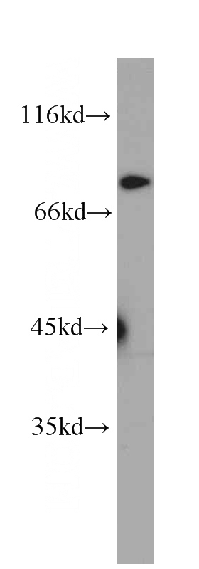HeLa cells were subjected to SDS PAGE followed by western blot with Catalog No:107020(BORIS antibody) at dilution of 1:1000