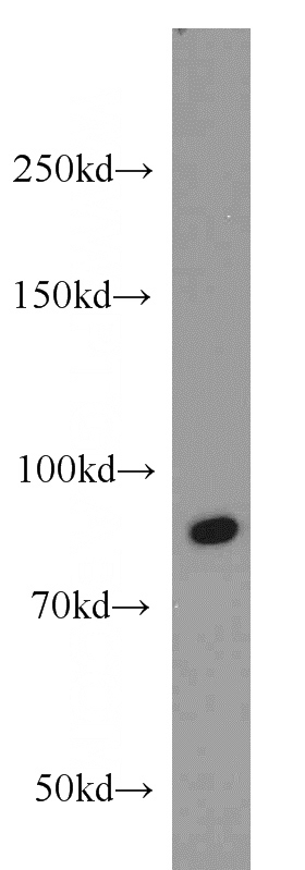 HepG2 cells were subjected to SDS PAGE followed by western blot with Catalog No:114937(RUNX1T1 antibody) at dilution of 1:600