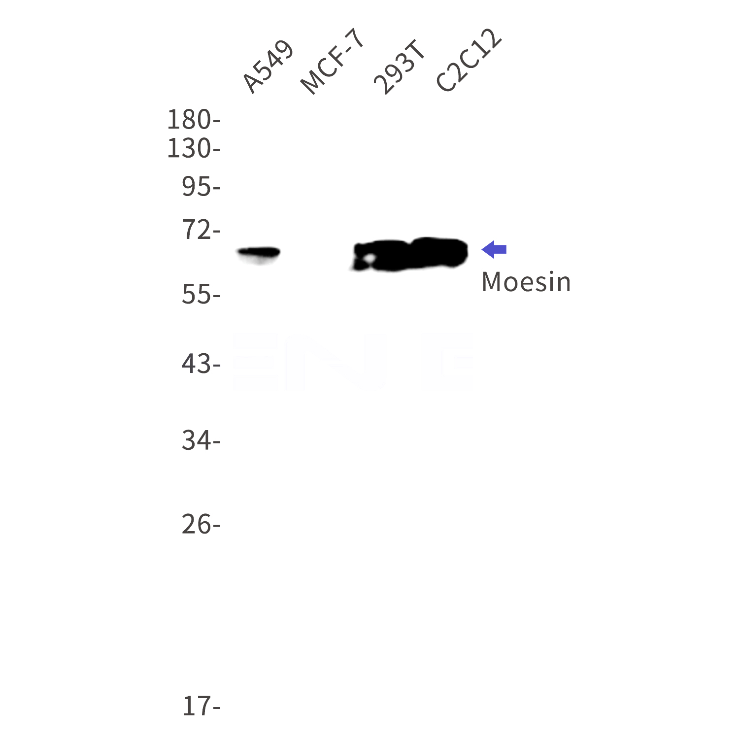 Western blot detection of Moesin in A549,MCF-7,293T,C2C12 cell lysates using Moesin Rabbit mAb(1:1000 diluted).Predicted band size:68kDa.Observed band size:68kDa.
