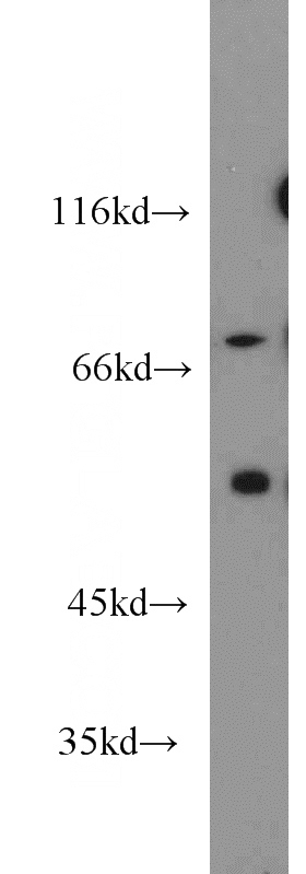 mouse pancreas tissue were subjected to SDS PAGE followed by western blot with Catalog No:115194(SERINC3 antibody) at dilution of 1:500