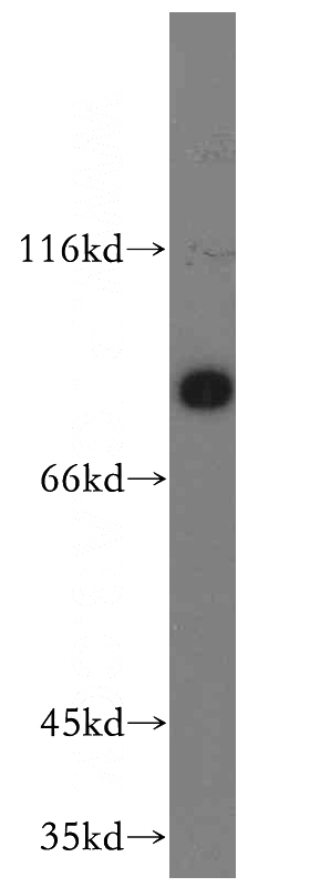 human placenta tissue were subjected to SDS PAGE followed by western blot with Catalog No:114997(SCIN antibody) at dilution of 1:300
