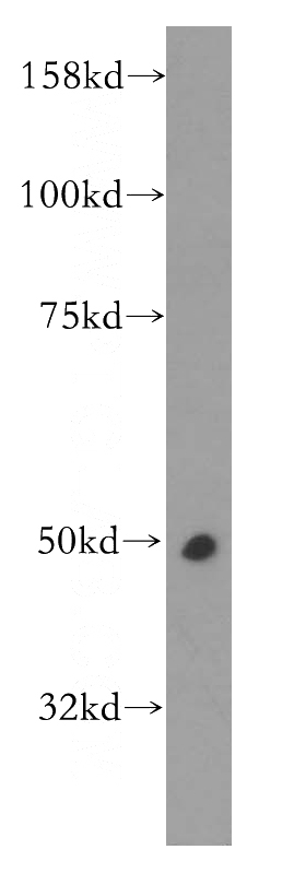 Raji cells were subjected to SDS PAGE followed by western blot with Catalog No:109514(CPN1 antibody) at dilution of 1:300