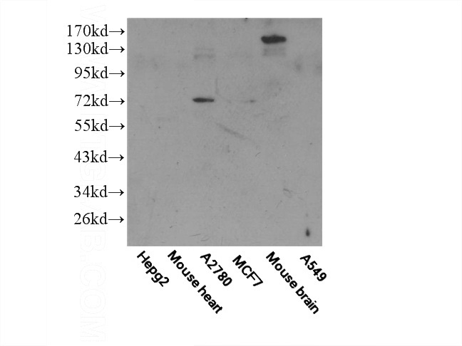 WB result of Catalog No:110774 (FZD8 Antibody).