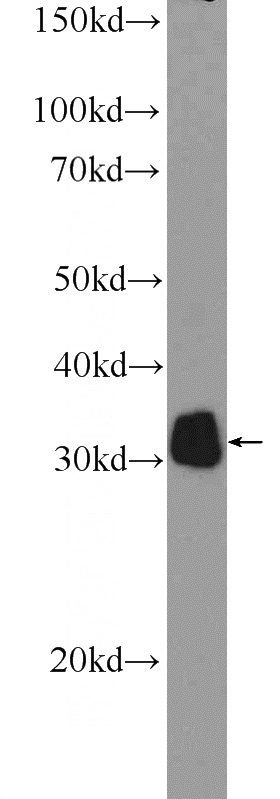 mouse kidney tissue were subjected to SDS PAGE followed by western blot with Catalog No:113552(P4HA3 Antibody) at dilution of 1:300