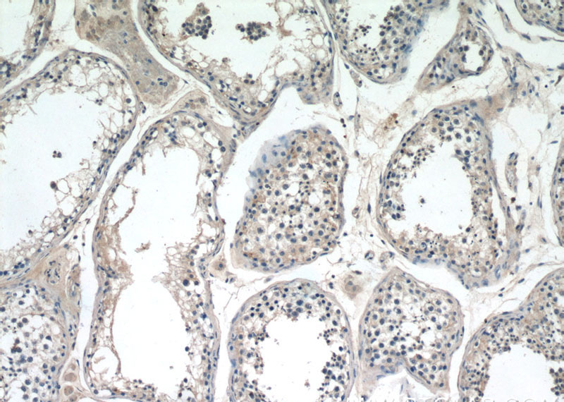 Immunohistochemistry of paraffin-embedded human testis tissue slide using Catalog No:109815(CYTSA Antibody) at dilution of 1:50 (under 10x lens)