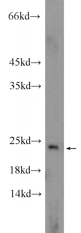 HepG2 cells were subjected to SDS PAGE followed by western blot with Catalog No:110175(EIF1AX Antibody) at dilution of 1:600