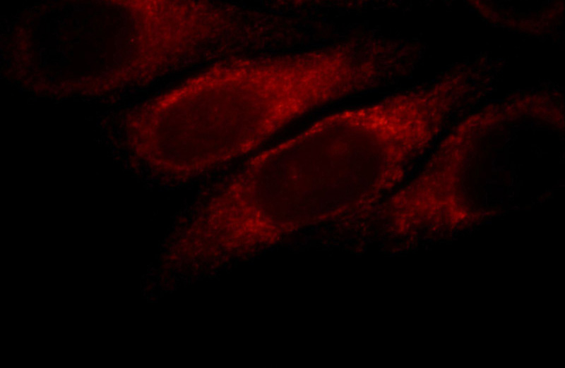 Immunofluorescent analysis of HepG2 cells, using SLC4A4 antibody Catalog No:115341 at 1:25 dilution and Rhodamine-labeled goat anti-rabbit IgG (red).