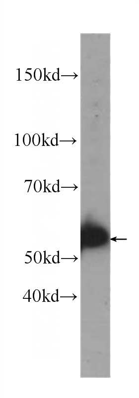 DU 145 cells were subjected to SDS PAGE followed by western blot with Catalog No:107490(PTEN Antibody) at dilution of 1:1000