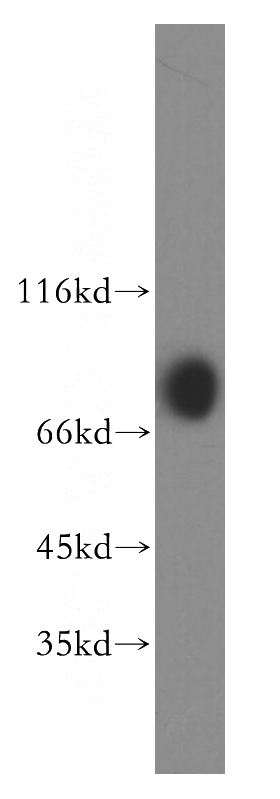 HeLa cells were subjected to SDS PAGE followed by western blot with Catalog No:114200(PRKCSH antibody) at dilution of 1:1000