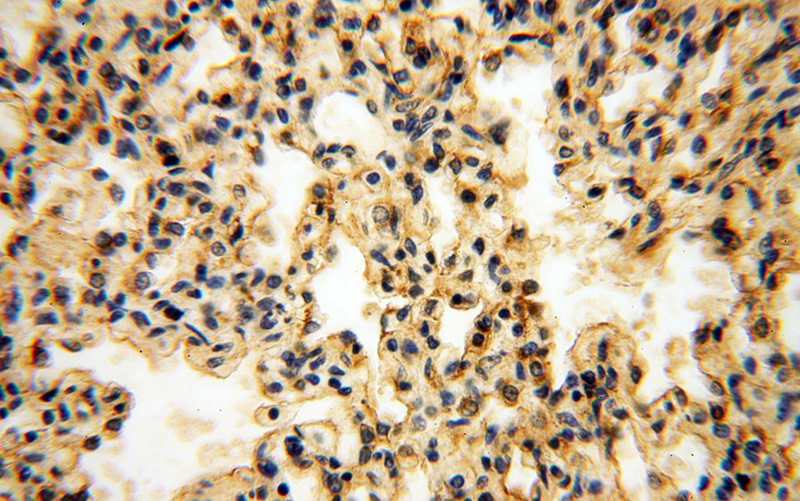 Immunohistochemical of paraffin-embedded human lung using Catalog No:110755(FXYD3 antibody) at dilution of 1:100 (under 40x lens)