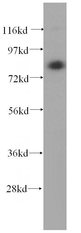 HeLa cells were subjected to SDS PAGE followed by western blot with Catalog No:116029(TGM2 antibody) at dilution of 1:400
