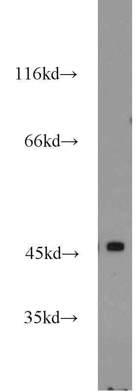 HeLa cells were subjected to SDS PAGE followed by western blot with Catalog No:108028(APOBEC4 antibody) at dilution of 1:1500