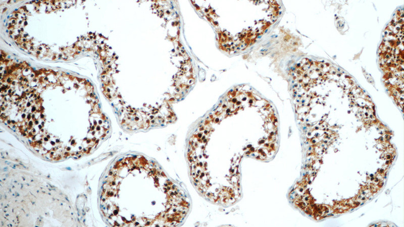 Immunohistochemistry of paraffin-embedded human testis tissue slide using Catalog No:114076(PP2A Antibody) at dilution of 1:50 (under 10x lens)