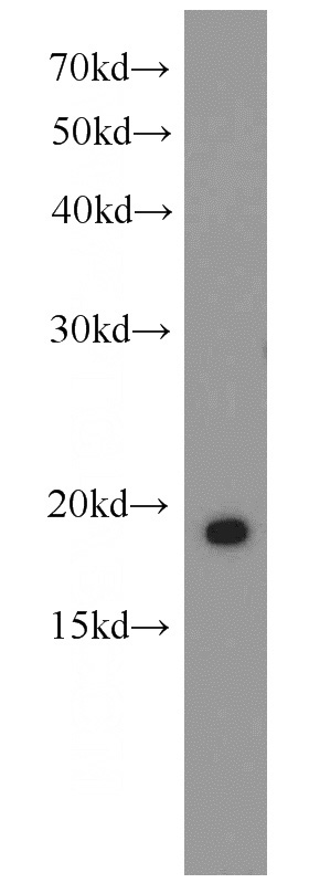 HEK-293 cells were subjected to SDS PAGE followed by western blot with Catalog No:114564(RBP7 antibody) at dilution of 1:1000