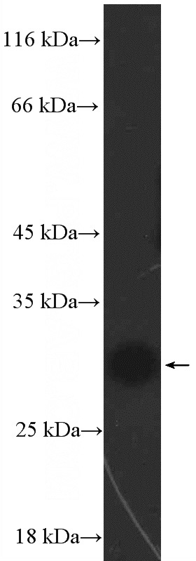 mouse liver tissue were subjected to SDS PAGE followed by western blot with Catalog No:108949(CBX7 Antibody) at dilution of 1:300