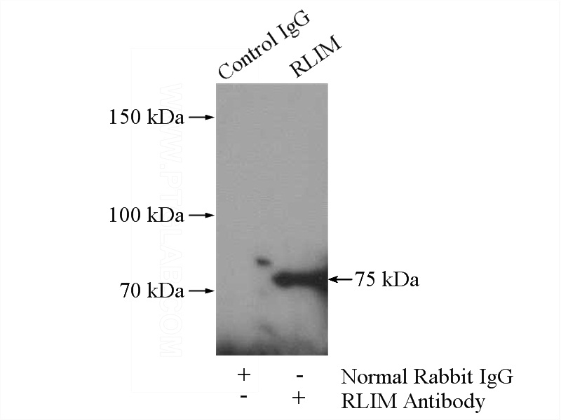 IP Result of anti-RLIM (IP:Catalog No:114721, 4ug; Detection:Catalog No:114721 1:500) with HeLa cells lysate 1520ug.
