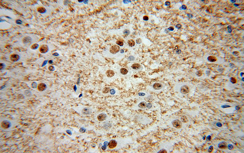 Immunohistochemical of paraffin-embedded human brain using Catalog No:111511(HNRNPR antibody) at dilution of 1:100 (under 40x lens)