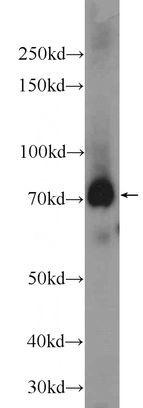 rat testis tissue were subjected to SDS PAGE followed by western blot with Catalog No:116378(TTC30A Antibody) at dilution of 1:1000