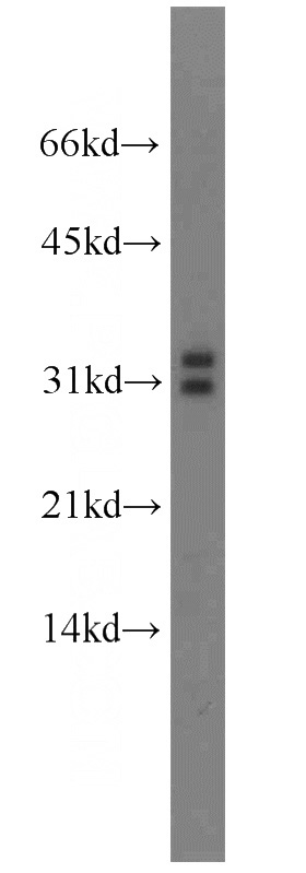 mouse testis tissue were subjected to SDS PAGE followed by western blot with Catalog No:112446(MARCH8 antibody) at dilution of 1:800
