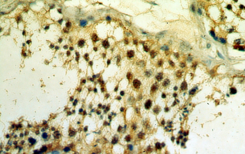 Immunohistochemical of paraffin-embedded human testis using Catalog No:114601(RBM16 antibody) at dilution of 1:100 (under 40x lens)