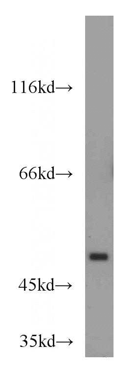 mouse lung tissue were subjected to SDS PAGE followed by western blot with Catalog No:116368(TSPYL1 antibody) at dilution of 1:500