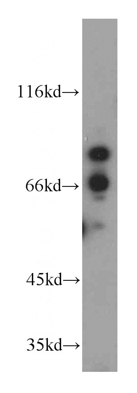 HeLa cells were subjected to SDS PAGE followed by western blot with Catalog No:113641(PDXDC1 antibody) at dilution of 1:500