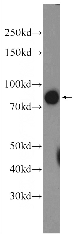 mouse kidney tissue were subjected to SDS PAGE followed by western blot with Catalog No:115353(SLCO4C1 Antibody) at dilution of 1:600