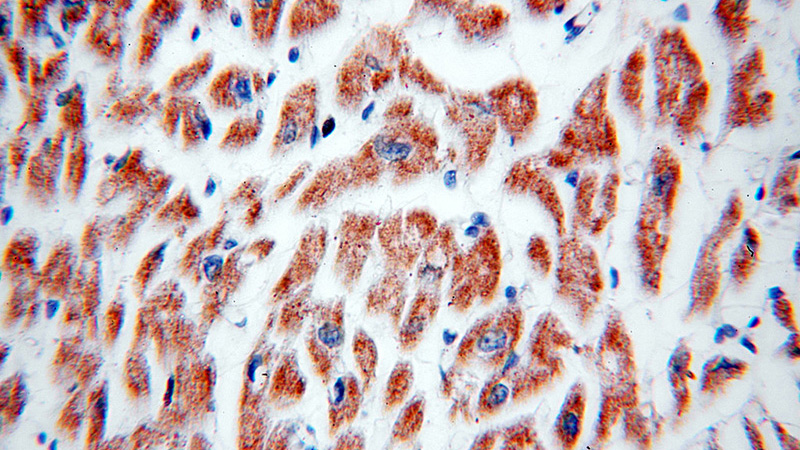 Immunohistochemical of paraffin-embedded human heart using Catalog No:110572(FAM156A antibody) at dilution of 1:50 (under 40x lens)